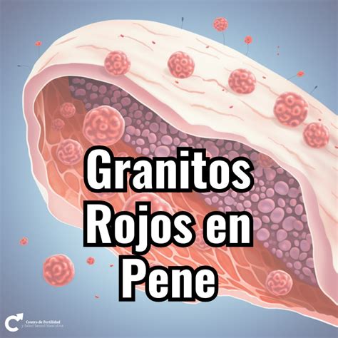 granos en la punta del pene|Puntos rojos en el pene: Causas, otros síntomas a